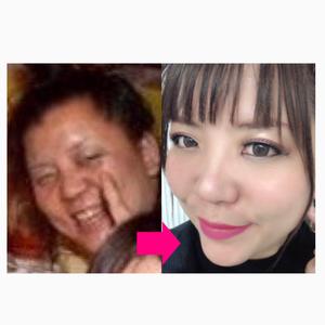 鼻の形が綺麗になる方法 Tiktok Hashtag 鼻の形が綺麗になる方法 Tiktok Hashtag