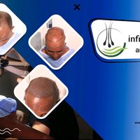 infinityhaircare.com